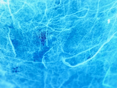 Blue Net