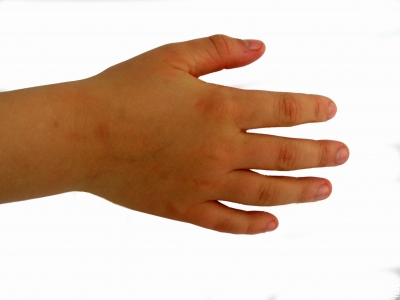 Kinderhand Handrücken rechts