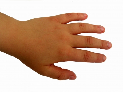 Kinderhand Handrücken links