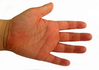 Kinderhand Handteller links